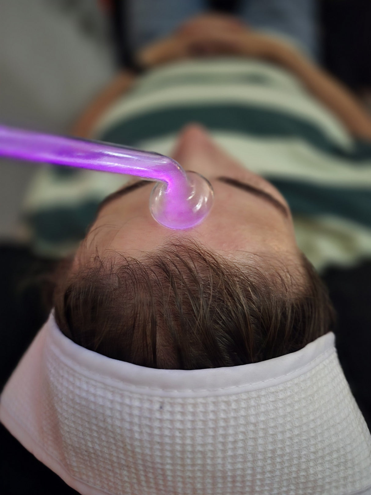 Tesla High-Frequency Hair Growth Therapy